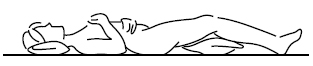linfedema-11