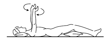 linfedema-12