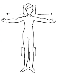 linfedema-13