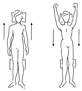 linfedema-14