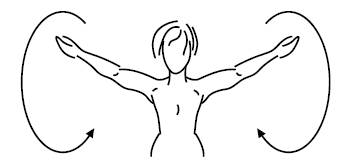 linfedema-23
