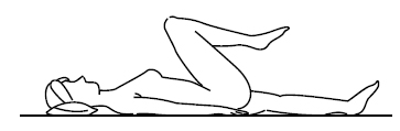 linfedema-24