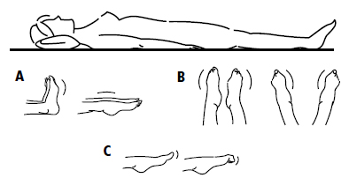 linfedema-27
