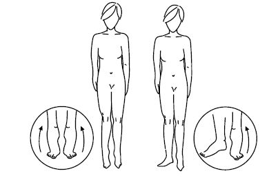 linfedema-28