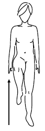 linfedema-29