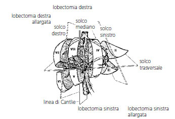 lobectomia
