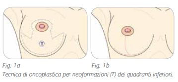 ricostruzione-1