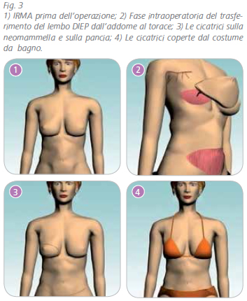 ricostruzione-3