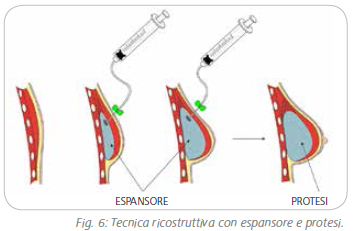 ricostruzione-6