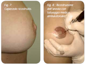 ricostruzione-7