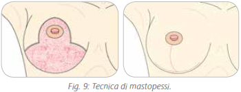 ricostruzione-8
