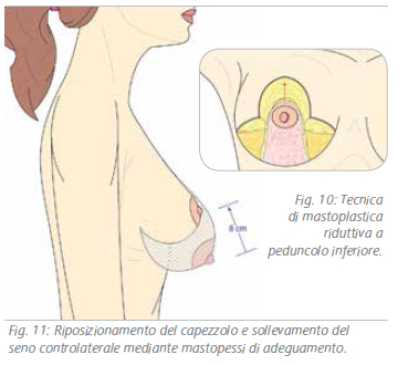 ricostruzione-9